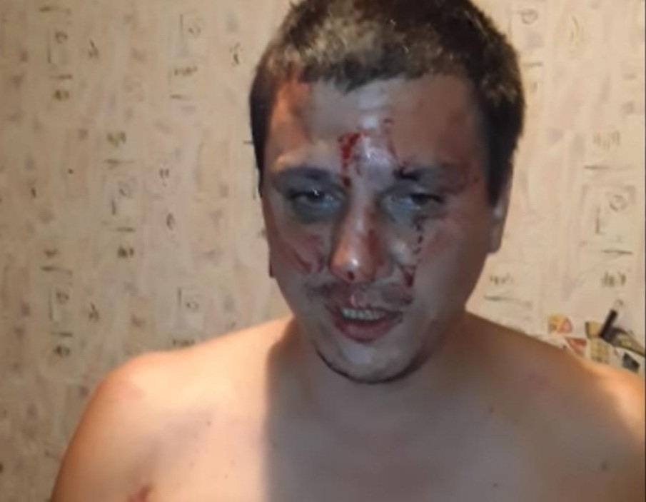 Националисты избили мужчину и заставили его сказать «люблю Украину»