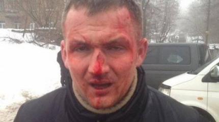 В Киеве "до потери сознания" избили нардепа от "Свободы" Юрия Левченко В Киеве "до потери сознания" избили нардепа от "Свободы" Юрия Левченко