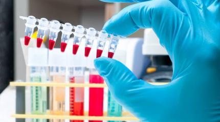 WADA выполняла заказ США, убивая российский спорт WADA выполняла заказ США, убивая российский спорт