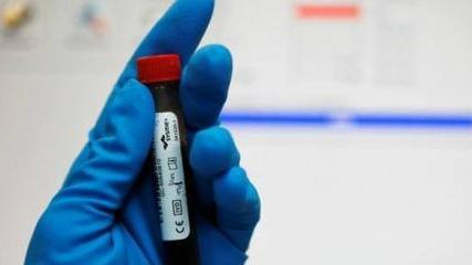 WADA выводят на чистую воду: раскрыты новые детали махинаций агентства