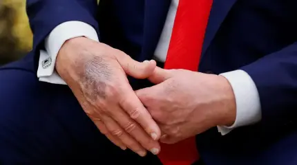 Слово офицера: У президента началась деменция, он оторвался от реальности