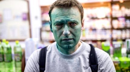 После нападения Навальный потерял зрение на 80% После нападения Навальный потерял зрение на 80%