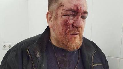 Избивать за георгиевские ленточки они скоро перестанут... Избивать за георгиевские ленточки они скоро перестанут...