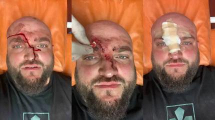Запрет русского языка в действии: Одессит избил мовнюка электропечкой