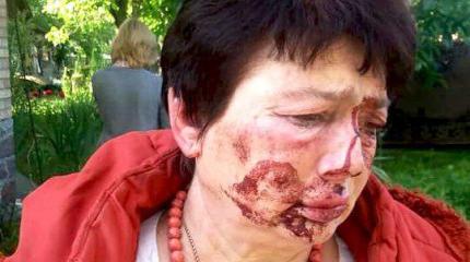 Будни новых европейцев: под Киевом избили главу избиркома Будни новых европейцев: под Киевом избили главу избиркома