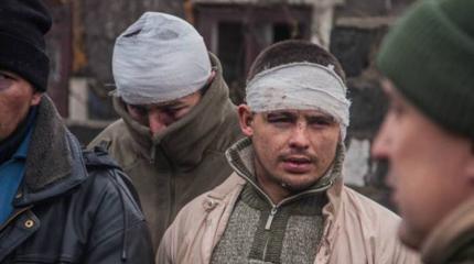 Истязания и никакой медицинской помощи: что происходит в украинском плену? Истязания и никакой медицинской помощи: что происходит в украинском плену?