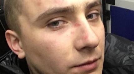В Одессе избили экс-лидера местного «Правого сектора» Сергея Стерненко В Одессе избили экс-лидера местного «Правого сектора» Сергея Стерненко