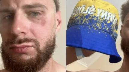 В Чехии поляки избили поляка в жёлто-синей панамке, приняв его за украинца