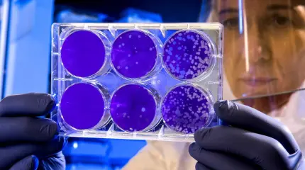 Разведка США отвергла версию о создании COVID-19 как биологического оружия Разведка США отвергла версию о создании COVID-19 как биологического оружия