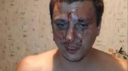 Националисты избили мужчину и заставили его сказать «люблю Украину» Националисты избили мужчину и заставили его сказать «люблю Украину»