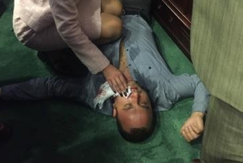 Политический «плюрализм» в Киеве: сломана челюсть и выбиты зубы Политический «плюрализм» в Киеве: сломана челюсть и выбиты зубы