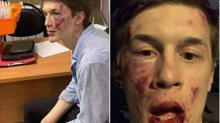 Несколько мыслей про избиение «запасного Навального» Егора Жукова Несколько мыслей про избиение «запасного Навального» Егора Жукова