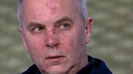 Драка у Шустера: Майданщик со спины напал на Шуфрича и расцарапал ему лицо Драка у Шустера: Майданщик со спины напал на Шуфрича и расцарапал ему лицо