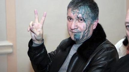 Аваков схватился за сердце от комментариев в Сети Аваков схватился за сердце от комментариев в Сети