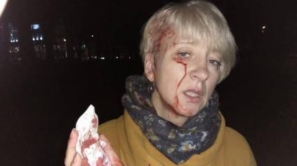 Соцсети обсуждают избиение судьи Ларисы Гольник в Полтаве Соцсети обсуждают избиение судьи Ларисы Гольник в Полтаве