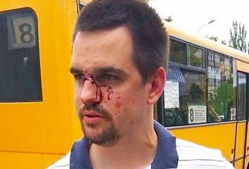 Западная Украина показала своё истинное отношение к «АТОшникам» Западная Украина показала своё истинное отношение к «АТОшникам»