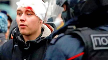 Россия на этой неделе "гибла как никогда прежде" Россия на этой неделе "гибла как никогда прежде"