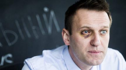 Зачем Навальному формируют образ жертвы? Зачем Навальному формируют образ жертвы?