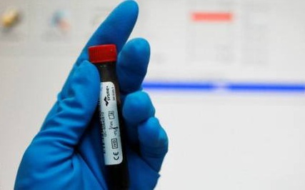 WADA выводят на чистую воду: раскрыты новые детали махинаций агентства