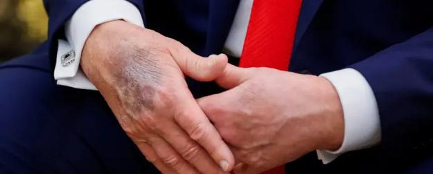 Слово офицера: У президента началась деменция, он оторвался от реальности