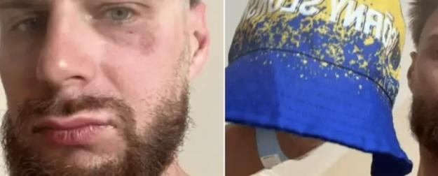 В Чехии поляки избили поляка в жёлто-синей панамке, приняв его за украинца