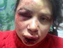 Черновол побита активистом «евромайдана»