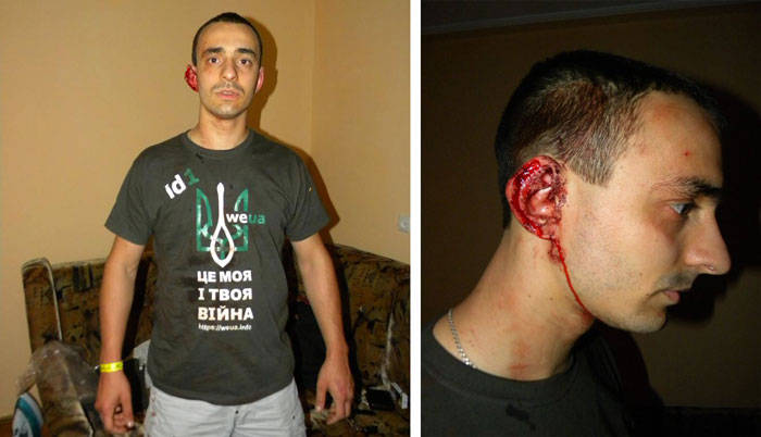 Основателя украинской соцсети WEUA.info побили во Львове за футболку с трезубцем
