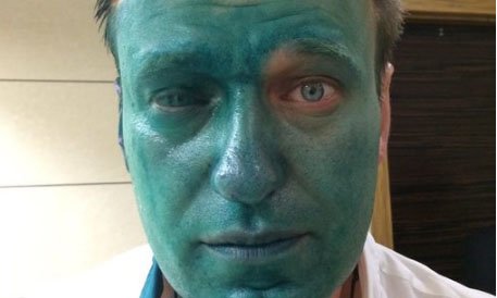 Навальному опять плеснули в лицо зеленкой