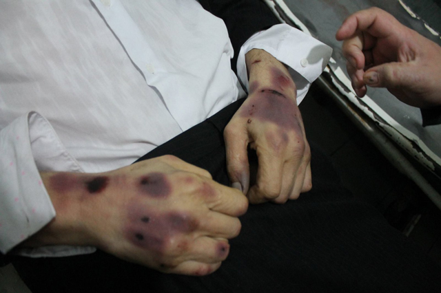 Совет Европы обеспокоился пытками в украинских тюрьмах