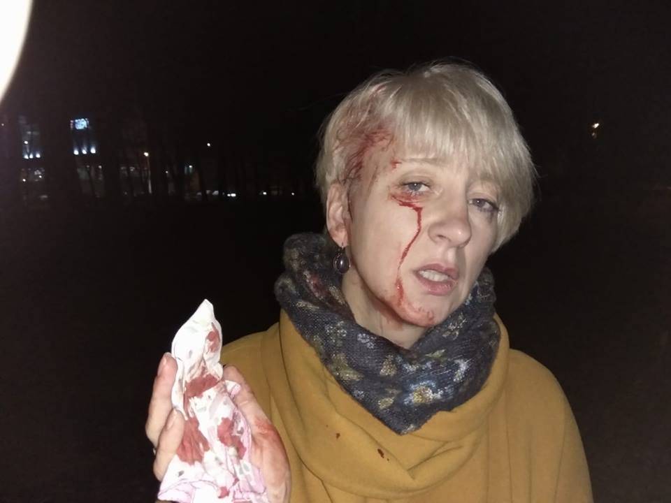 Соцсети обсуждают избиение судьи Ларисы Гольник в Полтаве