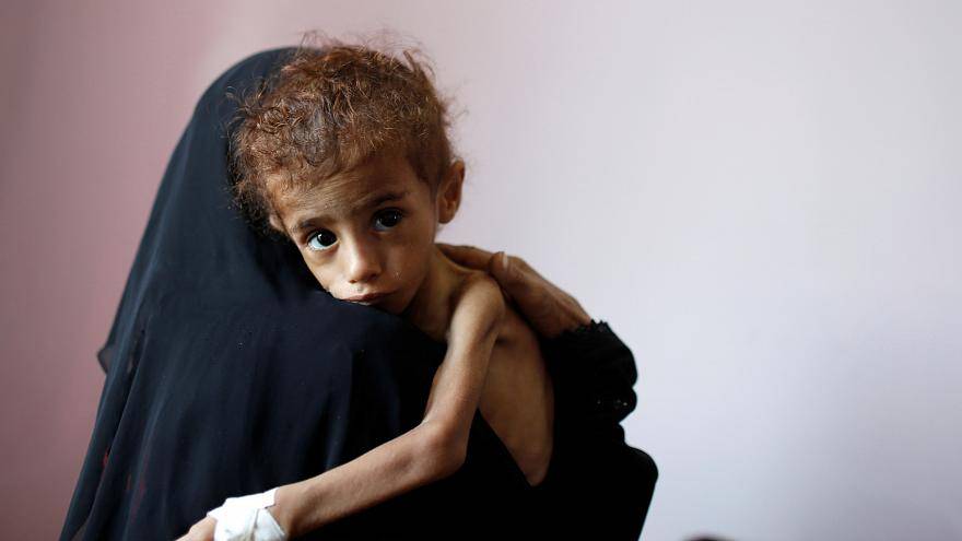 Голод в Йемене: "У детей нет сил даже плакать"