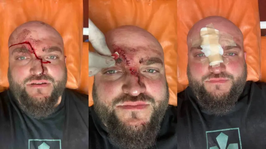 Запрет русского языка в действии: Одессит избил мовнюка электропечкой