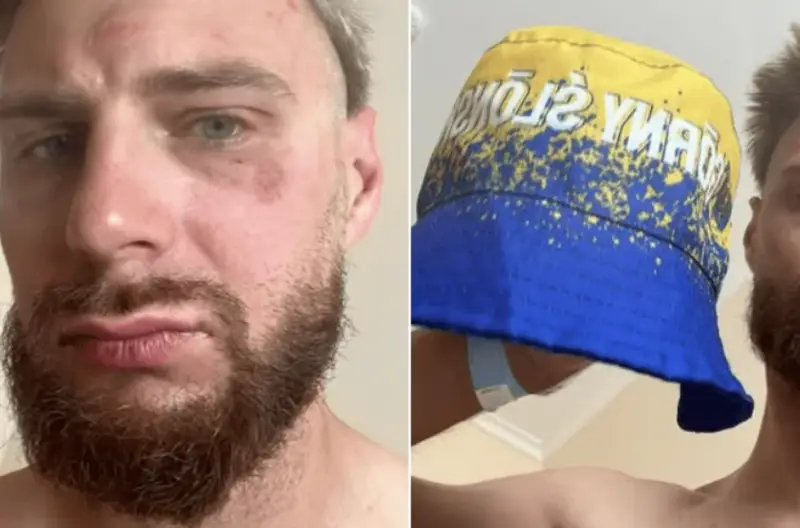 В Чехии поляки избили поляка в жёлто-синей панамке, приняв его за украинца